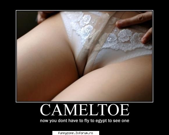 cameltoe